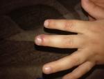 Опух палец руки фото 2