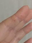 Болезненные трещины на пальцах фото 3