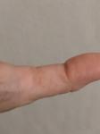 Болезненные трещины на пальцах фото 2
