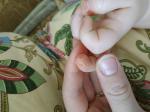 Изменение ногтей и кожи у ребенка 1,5 года фото 2