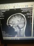Расшифровка МРТ мозга фото 1