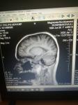 Расшифровка МРТ мозга фото 3