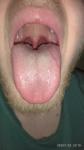 Болит язык, помогите с лечением фото 1