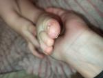 Изменение ногтей и кожи у ребенка 1,5 года фото 1