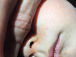Сыпь вокруг рта у годовалого малыша фото 1