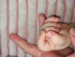 Изменение ногтей и кожи у ребенка 1,5 года фото 3