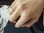 Красная точка на костяшке пальца фото 1