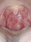 Болит горло без температуры фото 2