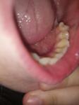 Зуб. Десна фото 3