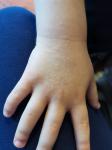 Что это за сыть на руке у ребёнка? фото 1