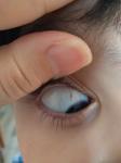 Болит глаз у ребенка фото 1