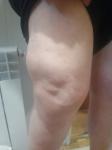 Сильная боль колено фото 3