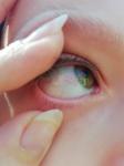 Красный сосуды в одном глазу у ребенка фото 1