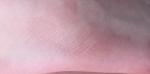 Розовые морщинистые пятна на ноге у ребёнка 12 лет. Не беспокоят фото 3
