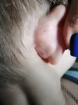 Ранки за ухом у ребенка 7 лет фото 1