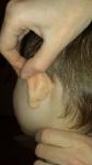 Шишка за ухом у ребенка фото 1
