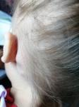 Лимфоузел за ухом у ребенка фото 2
