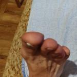 Подушечки пальцев ног фото 1