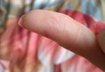 Аллергия / грибок на руках мастера маникюра фото 3