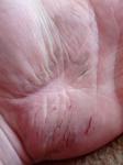 Пятна сухой кожи с трещинами на руках фото 3