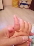 Пальчик у ребенка фото 1