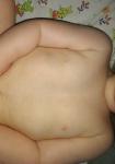 Покраснела грудь у ребенка 1,5 года фото 1