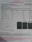 Плохой анализ тромбодинамики и Д-димера на на 16 неделе фото 1