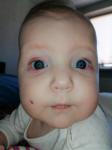 Покраснение глаз у ребёнка, 6мес фото 1