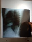 Рентгенография грудного отдела фото 2