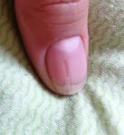 Полоса на ногте руки фото 1