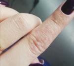 Сыпь на пальце руки фото 1