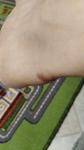 Болит нога после пореза ступни фото 1