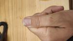Отслаиваются ногти от пальца после работы руками фото 2