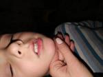 Пятна вокруг рта у ребенка фото 3