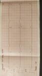 Расшифровка кардиограммы для прохождения комиссии на рудоустроство фото 3