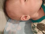 Пятно на щеке ребенка фото 2