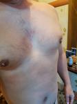 Шелушение кожи на груди фото 2