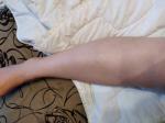 Болит нога ниже колена спереди фото 1