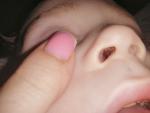 Что то непонятное в носу ребёнка фото 3
