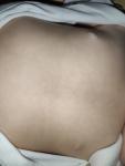 Уплотнение в правой груди у девочки в год фото 1