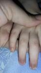 Ногти ломаются у ребенка фото 1