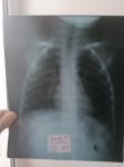 Рентген снимок ребёнку 3 года фото 2