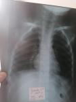 Рентген снимок ребёнку 3 года фото 3