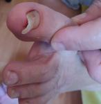 Как лечить ногти? фото 1