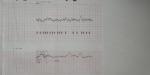 На ктг активные шевеления, тонус и высокая частота сердцебиения фото 1
