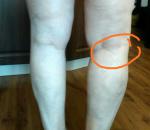 Боль в колене правой ноги фото 5