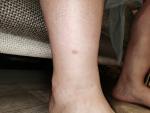 Пятнышко на ноге коричневого цаета фото 3
