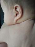 Красное высыпание на теле у ребенка 6 месяцев фото 2