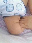 Сыпь у грудного ребенка фото 2