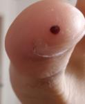 Черное пятно на пальце ноги фото 1